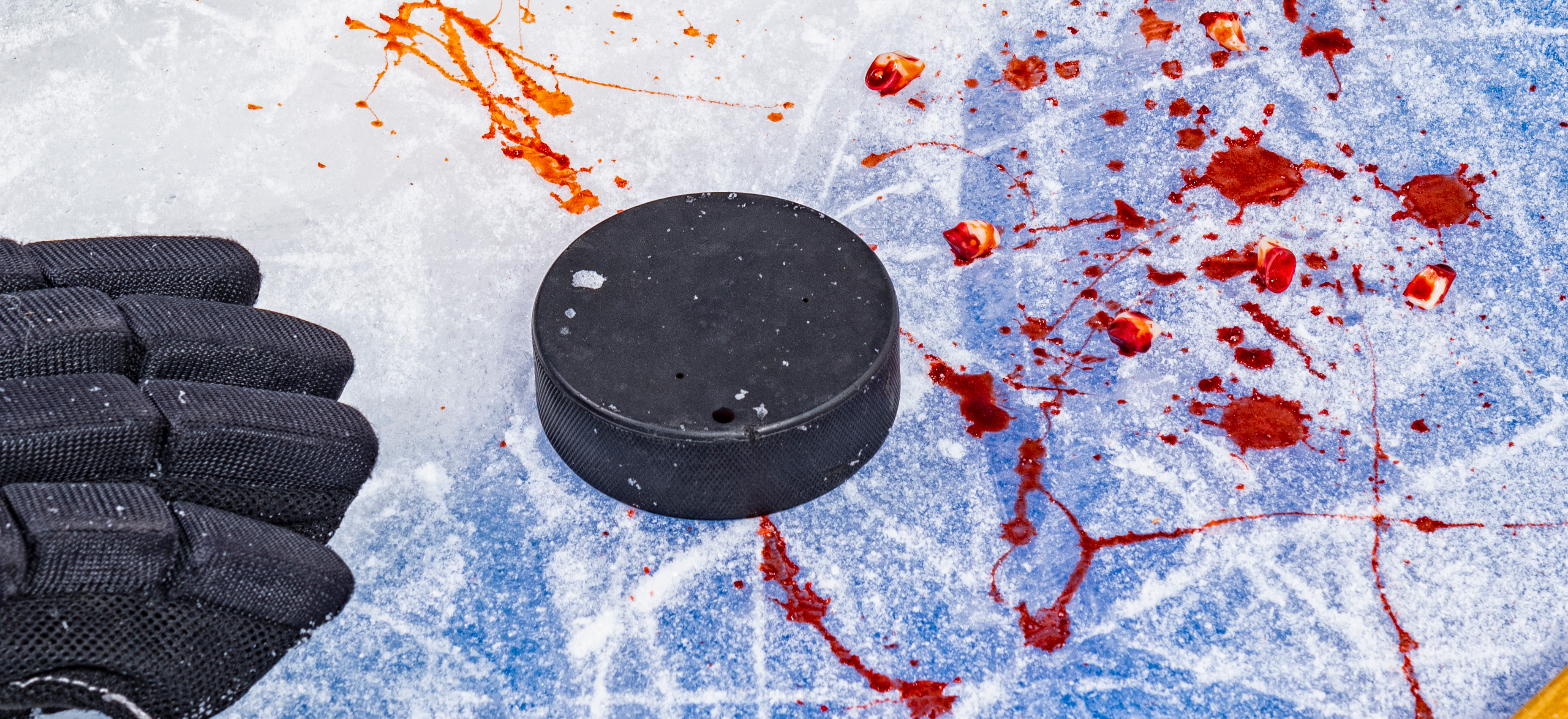 Högsta förvaltningsdomstolen avslår överklagandet med motiveringen att skatterevisorn spelade ishockey på eget initiativ och att ”aktiviteten ägde rum utan arbetsgivarens inblandning”.